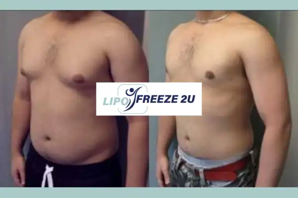 How Long Does It Take to See Results Swadlincote?