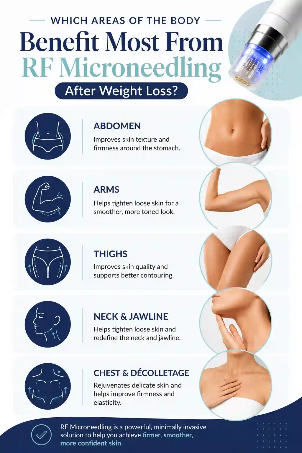 Which Areas of the Body Benefit Most From RF Microneedling After Weight Loss Swadlincote